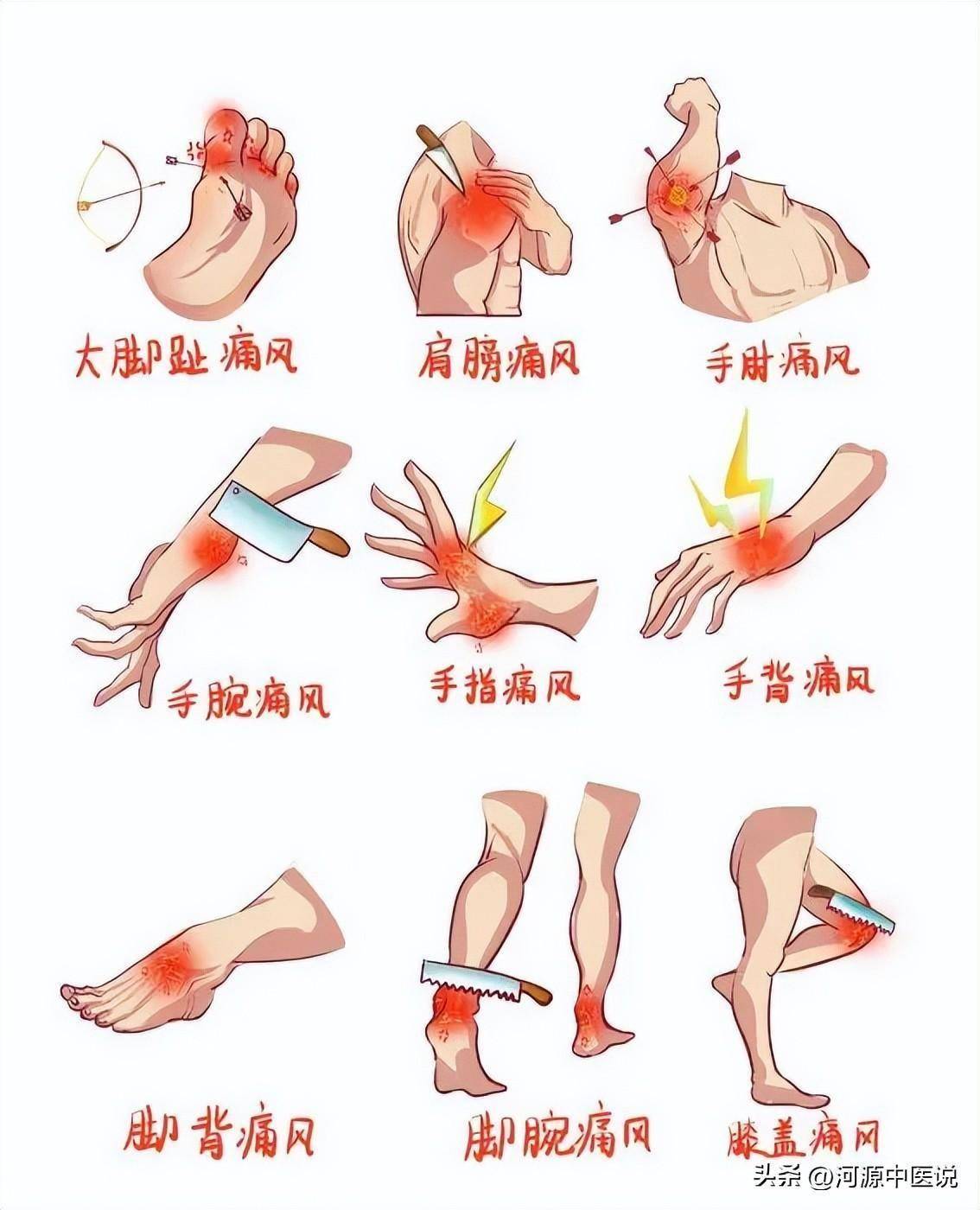 尿酸高有哪些症状(尿酸高有哪些症状出现)